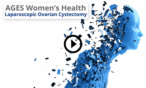Ovarian Cyst video