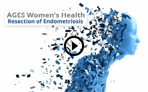Resection of Endometriosis video